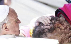 Pope Francis with John Merrick